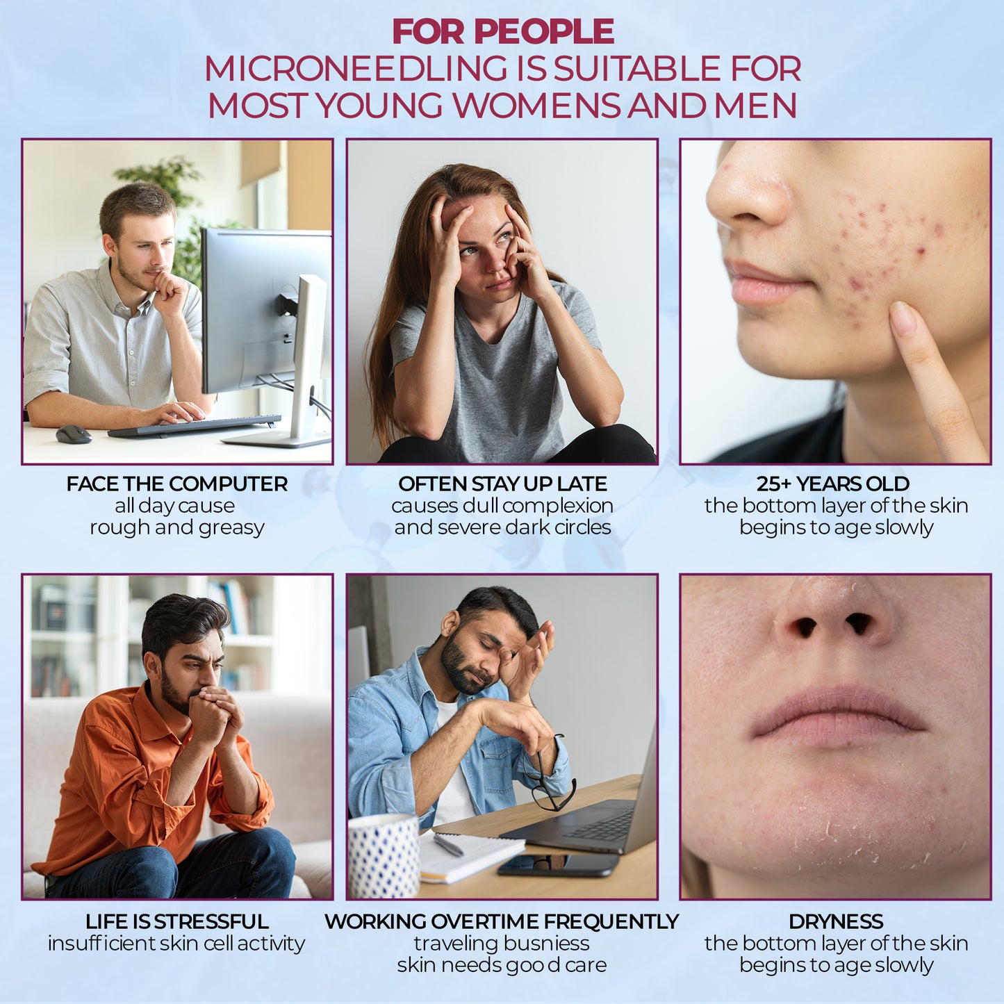 Derma Roller with 540 Titanium Microneedle for Hair